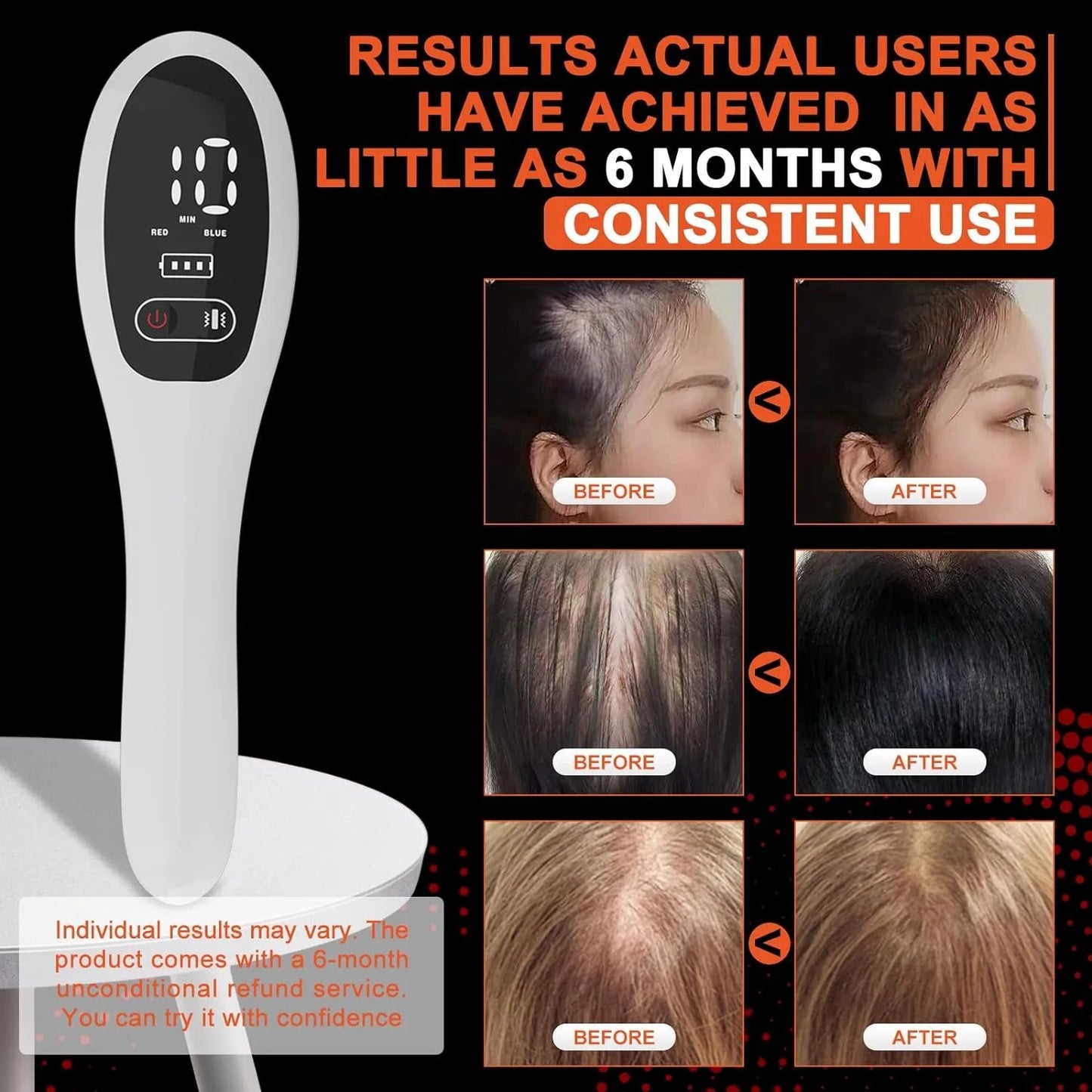 Radiance Red & Infrared Light Therapy Hair Brush
