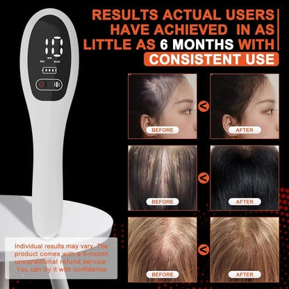 Radiance Red & Infrared Light Therapy Hair Brush