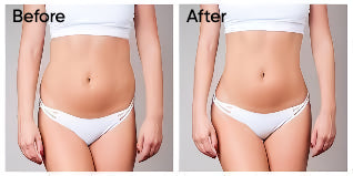 Red & Infrared Light LIPO Slimming Belt